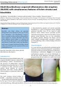 Cover page: Adult blaschkolinear acquired inflammatory skin eruption (BLAISE) with simultaneous features of lichen striatus and blaschkitis