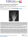Cover page: Glass Foreign Body Hand Radiograph
