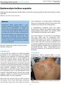 Cover page: Epidermolysis bullosa acquisita