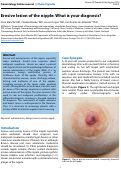 Cover page: Erosive lesion of the nipple: What is your diagnosis?