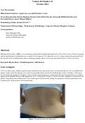 Cover page: Mid-dermal elastolysis: report of a case and literature review