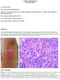 Cover page: New world cutaneous leishmaniasis