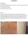 Cover page: Dermatitis herpetiformis