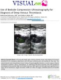 Cover page: Use of Bedside Compression Ultrasonography for Diagnosis of Deep Venous Thrombosis