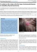 Cover page: A nodule on the scalp as the first sign of extranodal disease in medullary thyroid carcinoma