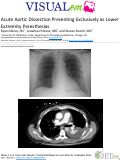 Cover page: Acute Aortic Dissection Presenting Exclusively as Lower Extremity Paresthesias
