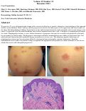 Cover page: Pemphigoid gestationis