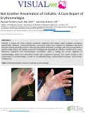 Cover page: Not Another Presentation of Cellulitis: A Case Report of Erythromelalgia