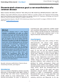 Cover page: Disseminated cutaneous gout: a rare manifestation of a common disease