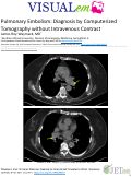 Cover page: Pulmonary Embolism: Diagnosis by Computerized Tomography without Intravenous Contrast