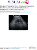 Cover page: Computed Tomography and Ultrasound Diagnosis of Spontaneous Subcapsular Renal Hematoma