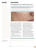 Cover page: Emerging Issues in Adult Female Acne.
