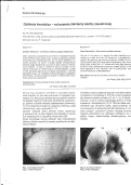 Cover page: Dziobata keratoliza - schorzenie zolnierzy słuzby zasadniczej