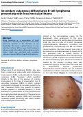 Cover page: Secondary cutaneous diffuse large B-cell lymphoma presenting with focal vesicular lesions