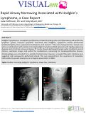 Cover page: Rapid Airway Narrowing Associated with Hodgkin’s Lymphoma, a Case Report