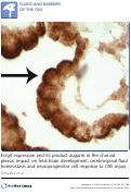 Cover page: Ecrg4 expression and its product augurin in the choroid plexus: Impact on fetal brain development, cerebrospinal fluid homeostasis and neuroprogenitor cell response to CNS injury