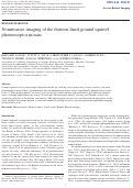 Cover page: Noninvasive imaging of the thirteen-lined ground squirrel photoreceptor mosaic