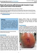 Cover page: Basal cell carcinoma with intravascular invasion: A case report and review of the literature