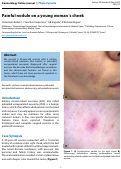 Cover page: Painful nodule on a young woman's cheek