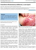 Cover page: Granuloma inframammary adultorum, a case report