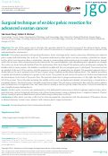 Cover page: Surgical technique of en bloc pelvic resection for advanced ovarian cancer