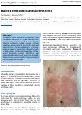 Cover page: Bullous eosinophilic annular erythema