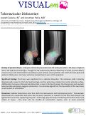 Cover page: Talonavicular Dislocation