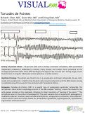 Cover page: Torsades de Pointes