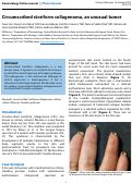 Cover page: Circumscribed storiform collagenoma, an unusual tumor