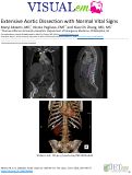 Cover page: Extensive Aortic Dissection with Normal Vital Signs