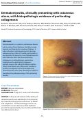 Cover page: Dermatomyositis, clinically presenting with cutaneous ulcers, with histopathologic evidence of perforating collagenosis