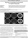 Cover page: Hyperdense Cerebral Sinus Vein Thrombosis  on Computed Tomography