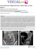 Cover page: Cecal Volvulus Diagnosed with a Whirl Sign: A Case Report