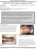 Cover page: Bilateral Foot Skin Eruption in a Hepatitis C Patient