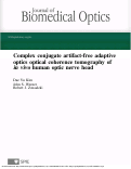 Cover page: Complex conjugate artifact-free adaptive optics optical coherence tomography of in vivo human optic nerve head