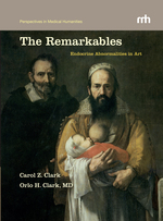 Cover page: The Remarkables: Endocrine Abnormalities in Art