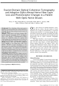 Cover page: Fourier-Domain Optical Coherence Tomography and Adaptive Optics Reveal Nerve Fiber Layer Loss and Photoreceptor Changes in a Patient With Optic Nerve Drusen