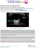 Cover page: Posterior Vitreous Detachment