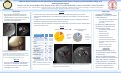 Cover page: MRI Low Signal Prominence at the Anteroinferior Glenohumeral Joint Recess: Frequency, Associated MRI Findings, and Arthroscopic Correlation