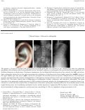 Cover page: Ochronotic Arthropathy