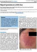 Cover page: Majocchi granuloma on a child's face