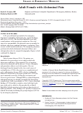 Cover page: Adult Female with Abdominal Pain