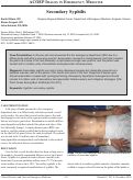 Cover page: The Evolution of Ultrasound in Medicine:  A Case Report of Point-of-care Ultrasound in the Self-diagnosis of Acute Appendicitis