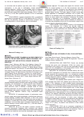 Cover page: MP78-14 INTERNATIONAL EXPERT CONSENSUS ON DEVELOPMENT OF A STATE OF THE ART MALE GENITAL SIMULATION MODEL FOR URETHROPLASTY AND ARTIFICIAL URINARY SPHINCTER INSERTION