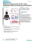 Cover page: Multiplexed imaging reveals an IFN-γ-driven inflammatory state in nivolumab-associated gastritis