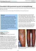 Cover page: Sarcoidosis with prominent necrosis on histopathology