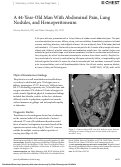 Cover page: A 44-Year-Old Man With Abdominal Pain, Lung Nodules, and Hemoperitoneum