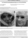 Cover page: An Unusual Facial Impalement Injury in a 75-Year-Old Male