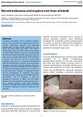 Cover page: Nevoid melanoma and eruptive nevi from erlotinib