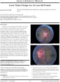Cover page: Acute Vision Change in a 16-year-old Female